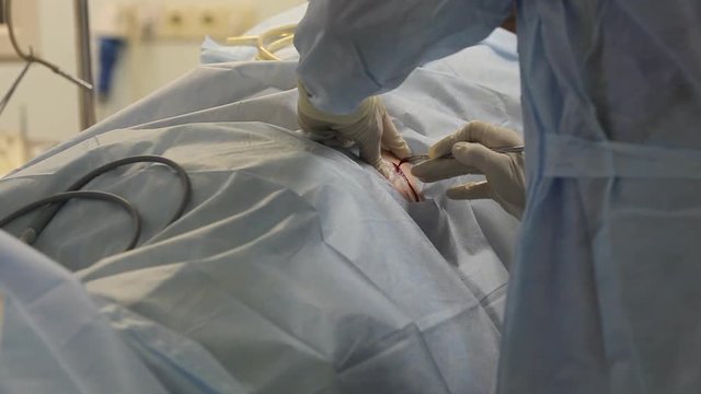 the surgeon makes a small incision to start the operation. close-up