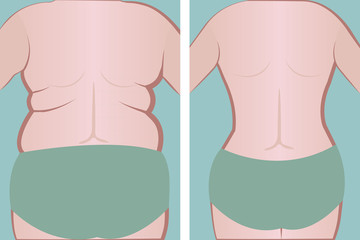 Fat and slim girl's back.  vector