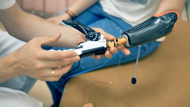 Robotic limb, prosthesis. Girl use bionic 3d printed arm for the first time. 4K.