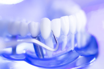 Fototapeta na wymiar Dental teeth dentist model