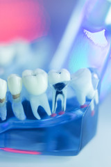 Dental teeth dentist model