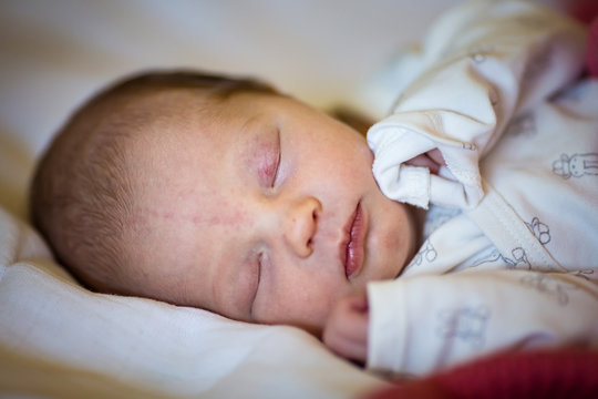Newborn baby girl sleeping in her crib, lit by the morning sun; stork bites visible on forehead and eyelids
