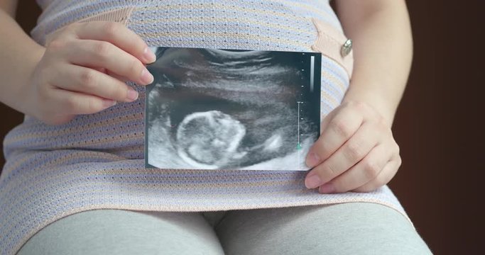 Pregnant woman holding ultrasound baby image