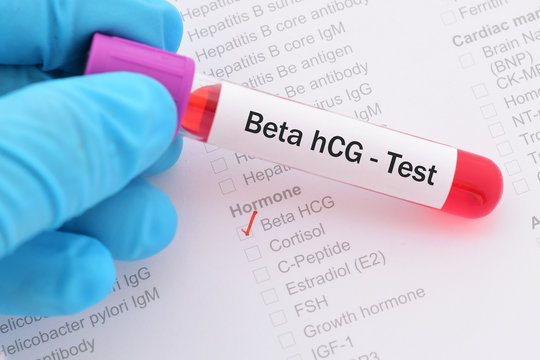 Blood sample with requisition form for beta hCG hormone test