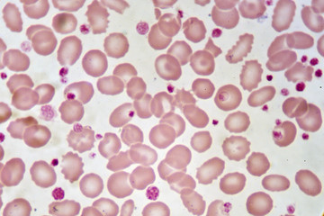 Red blood cells and platelet in blood smear
