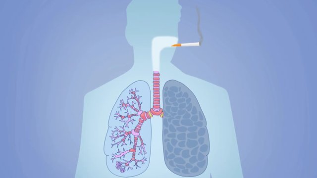 Lungs - animation - xray