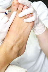 Pedicure treatment