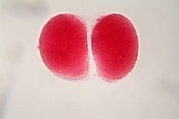 Egg cell under the microscope.