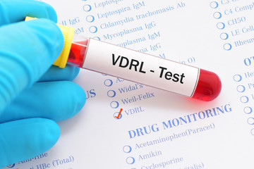 Blood sample with requisition form for VDRL test, diagnosis for syphilis infection
