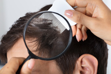 Dermatologist Checking Patient's Hair With Magnifying Glass