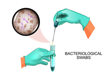bacteriological swabs - obrazy, fototapety, plakaty