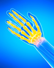 3d rendered medically accurate illustration of the hand bones