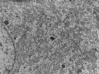 Neuron. Cell organelles, TEM