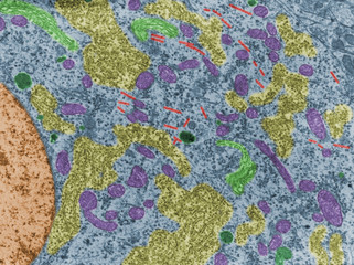 Neuron. Cell organelles. False colour TEM