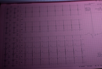 ekg sheet at a doctors desk office