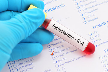 Obraz premium Blood sample with requisition form for testosterone hormone test
