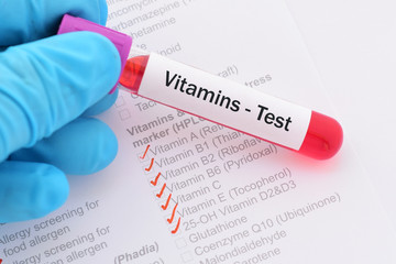 Blood sample with requisition form for vitamins test © jarun011