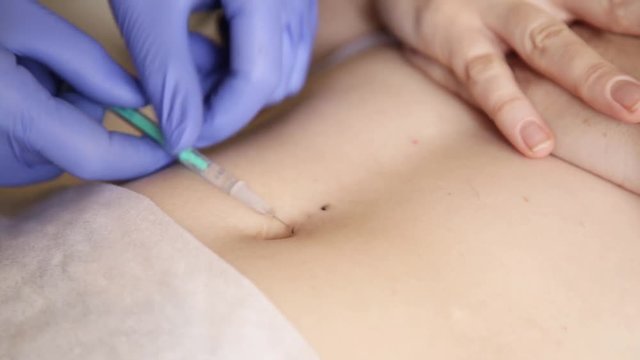 Operation to install navel piercing. doctor makes navel puncture