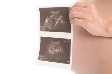 Obraz premium Portrait of pregnant woman show ultrasound film on white background,Free form copy space.