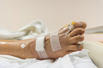 Patient in the hospital with saline intravenous