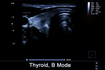Fototapeta na wymiar Colourful image of modern ultrasound monitor
