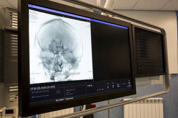 Human head X-ray image