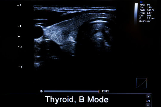 Colourful image of modern ultrasound monitor