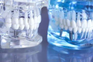 Dentsts dental teeth model