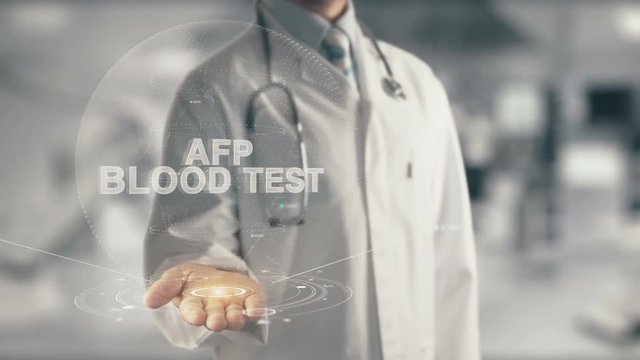 Doctor holding in hand AFP Blood Test