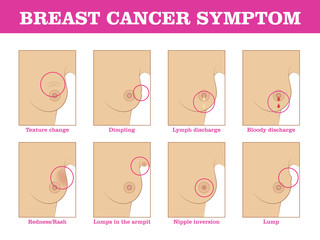 Breast cancer symptoms infographic. Methods for detecting breast cancer using self-testing for designers and illustrators. Timely care of woman health in the form of a vector illustration