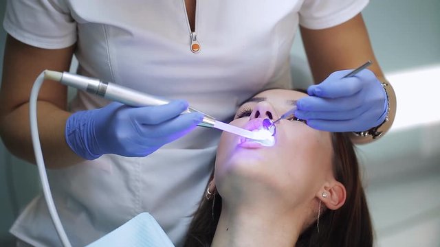 Woman at dentist clinic gets dental treatment to fill a cavity in a tooth. Dental restoration and material polymerization with UV light. Odontic and mouth health is real protection from caries decay.