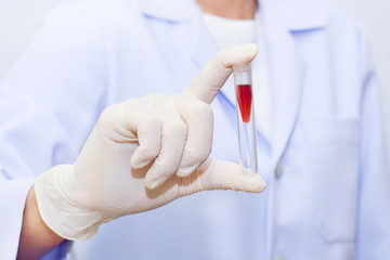 science, chemistry, biology, medicine and people concept - close up of young female scientist holding tube with blood sample making and test or research in clinical laboratory