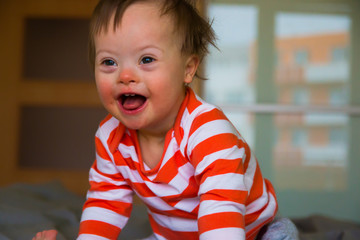 Portrait of cute baby boy with Down syndrome © dtatiana