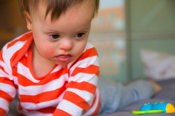 Portrait of cute baby boy with Down syndrome