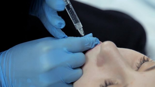 In the clinic, a medical cosmetologist injects Botox with a girl to increase her lips. Close-up.
