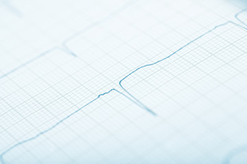 Curve line on the graph paper