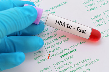 Blood sample with requisition form for HbA1c test
