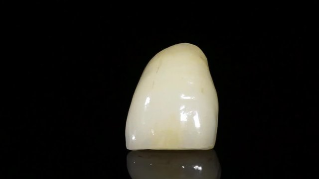 Vollkeramikkrone bemalt im Dentallabor