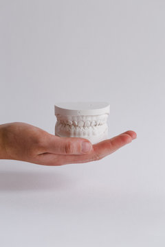 Hand holding plaster models of upper and lower teeth - vertical