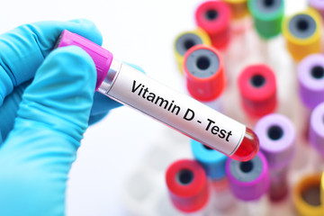Blood sample for vitamin D test