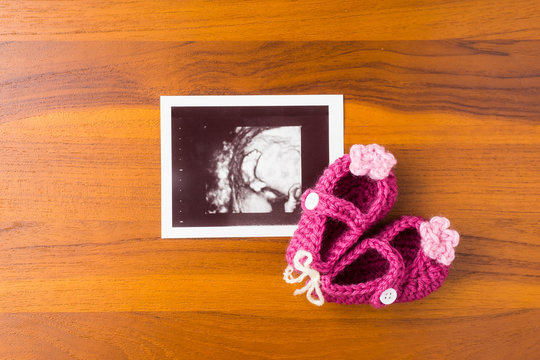 photo of ultrasound baby foot with cute pink wool shoe on wood desktop