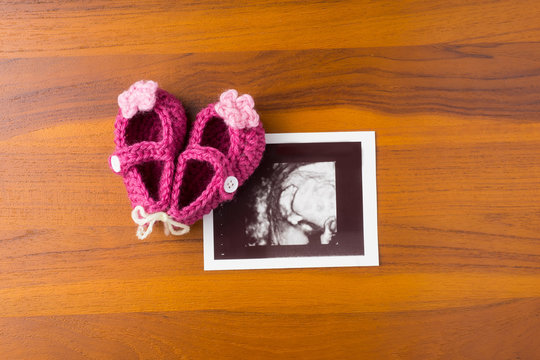photo of ultrasound baby foot with cute pink wool shoe on wood desktop