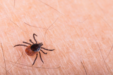 Detail of deer tick on human skin. Ixodes ricinus. Dangerous parasite and carrier of infection such as encephalitis and Lyme borreliosis.  Tiresome insect.