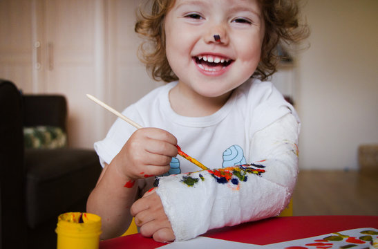 the child paints paints on a plaster of a hand. a broken arm in a small child
