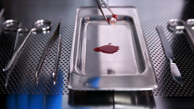 the surgeon throws the bullet on the tray after surgery
