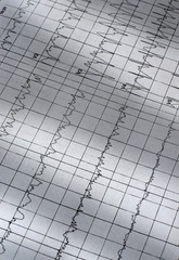 Electrocardiogram chart as medical background