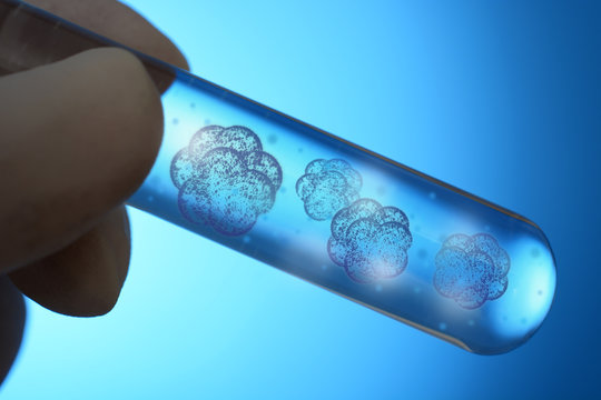 Stammzellen in Reagenzglas für Stammzellforschung
