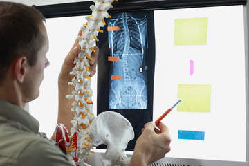 Scoliosis - Specialist with  model  of spine watching image of chest  at x-ray film viewer,....