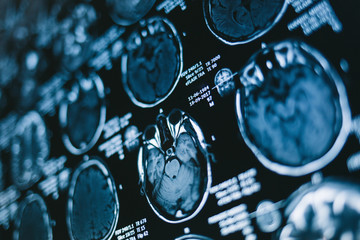 Magnetic resonance scan of the brain. Medicine, science  - obrazy, fototapety, plakaty