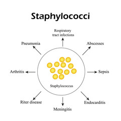 Staphylococci. Staphylococcus aureus causes diseases. Infographics. Vector illustration - obrazy, fototapety, plakaty